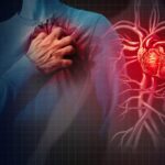 Insuffisance cardiaque
